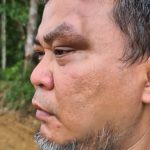 Camat Tenggarong Dianiaya, Negur Operator Tambang Ilegal yang Terobos Kebunnya