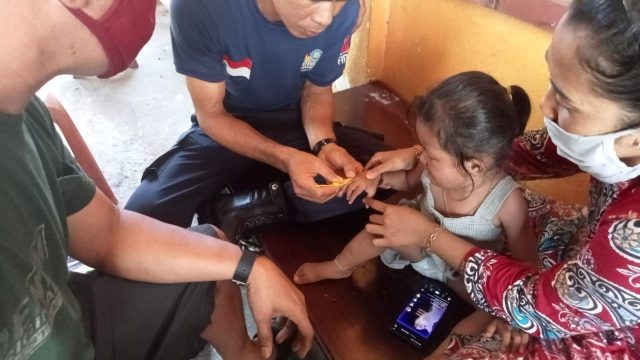 Balita Minta Bantuan Potong Cincin hingga Kobra di Kandang Ayam