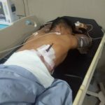 Ditikam, Pria Ini Kendarai Motor ke Rumah Sakit dengan Badik Masih Tertancap