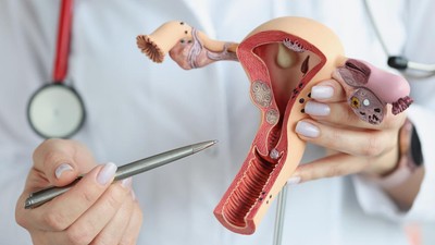 400 Ribu Perempuan Indonesia Terancam Kanker Serviks