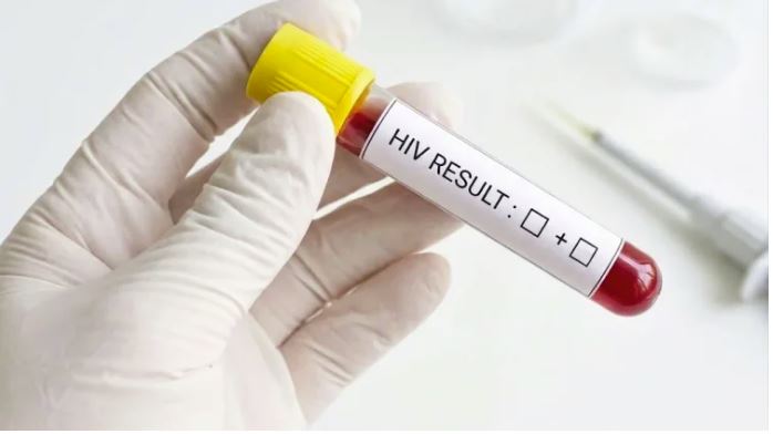 Stigma Jadi Hambatan, Kesadaran Tes HIV di Samarinda Masih Rendah