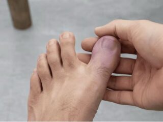 Jempol Kaki Kebas Jangan Dianggap Sepele, Kenali 6 Penyebab dan Cara Mengatasinya