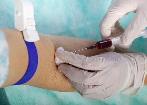 Tanda-Tanda Kolesterol Tinggi yang Penting Diketahui